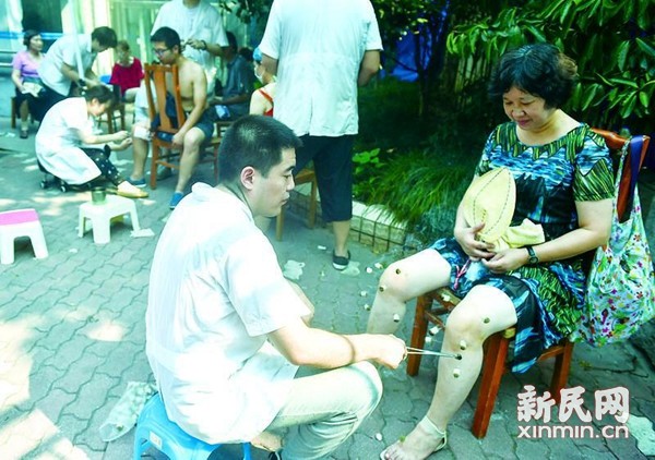 普陀区中心医院康复科医生 汗流浃背为患者拔