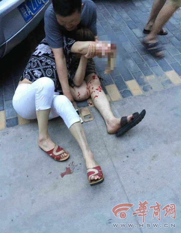 西安大风刮掉屋顶铁皮 过路女手腕几乎被