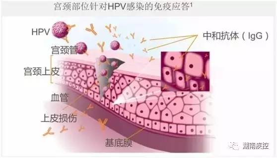 宫颈癌疫苗9月到湖南,超过25岁怎么办?看这里