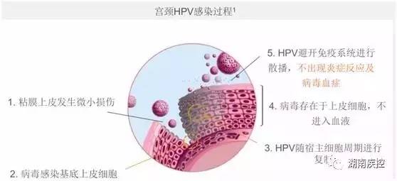 宫颈癌疫苗9月到湖南,超过25岁怎么办?看这里