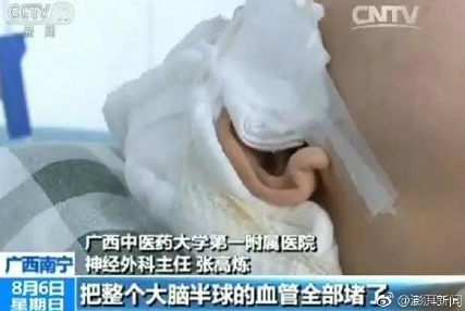什么情况下要打生发针 9Itd-fyitapp2188295.png
