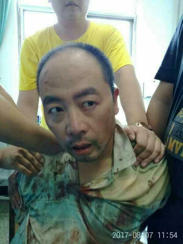 河北武安发生一起持刀伤人案件 致3死4伤|武安