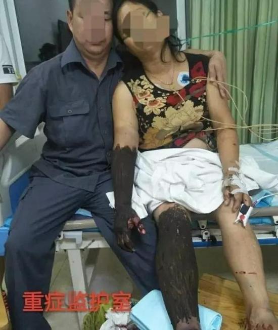 牛X！老妇暴怒之下手撕毒蛇为儿加菜 然后真相却是... - 7