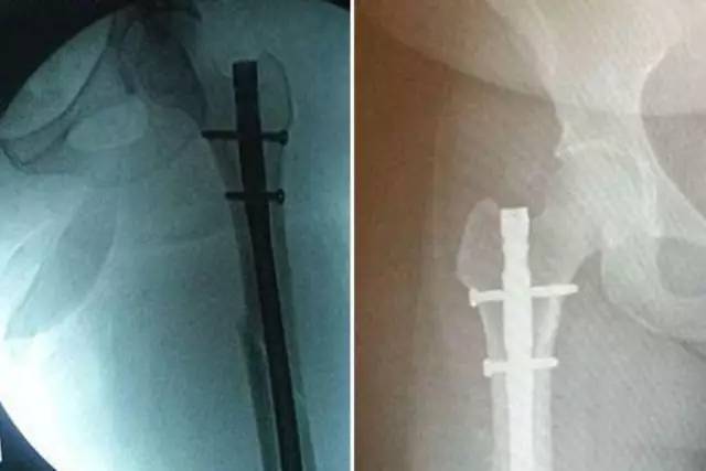 长途坐副驾这个动作很舒服,但是分分钟会让你断腿!