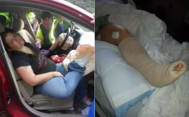 长途坐副驾这个动作很舒服,但是分分钟会让你断腿!