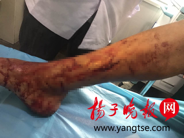 点击图片查看详情 战争与人口问题_...游戏有效解决了战争和人口问题.小精灵在敌对双方阵地上(3)