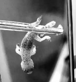 感觉耳朵里有东西在动结果医生从他耳道里夹出