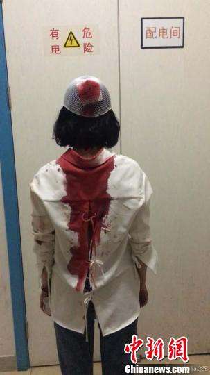 女游客自曝昆明街头被打头缝6针 官方介入调查