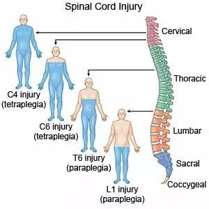 利用干细胞疗法治疗脊髓损伤进展梳理