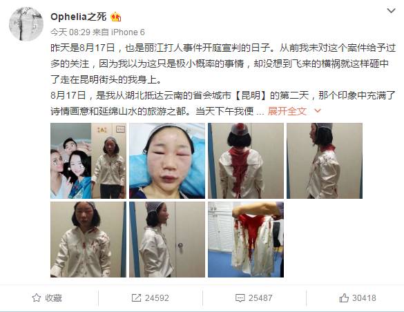 丧心病狂!女大学生昆明旅游莫名遭摩托男暴打