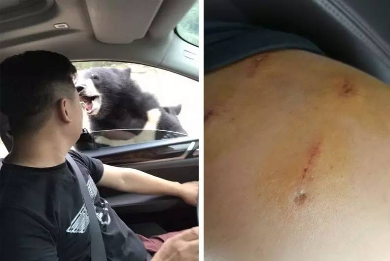 △据媒体报道,一名陈姓女子和朋侪开车离开黑熊园,看到他人投喂没什么事,陈姓女子就把车窗翻开一条小缝,往外扔食物。一只熊叼起食物就在一旁开吃了,另一只熊立刻围了过去,扒着车窗试图把头伸进车内(车窗有防夹功效),并咬伤他之左臂。(图/北京晚报)