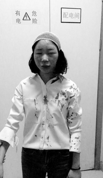 昆明被打学生申请重新鉴定|鉴定|昆明|司法鉴定