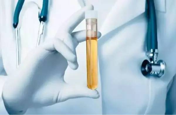 【健康】尿液这些颜色最可怕,当心膀胱癌前兆!"嘘嘘"时看一眼真能救命!|血尿|膀胱癌|尿液_新浪新闻