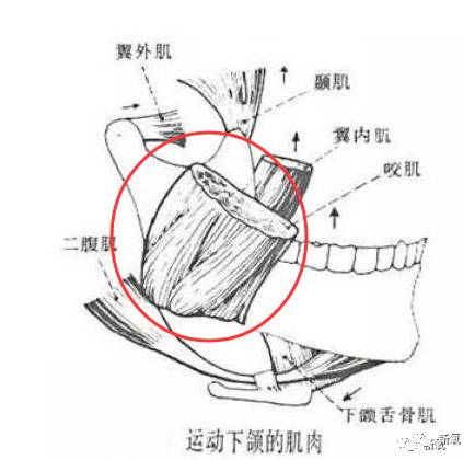 肌肉型