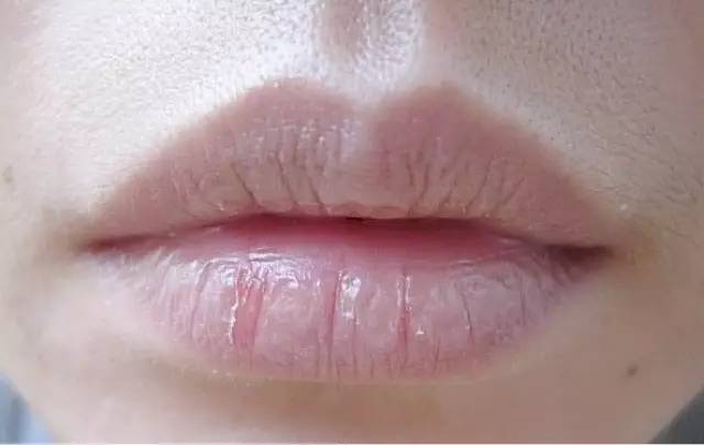 褪色的嘴唇歌曲谱_上嘴唇部分褪色变肉色