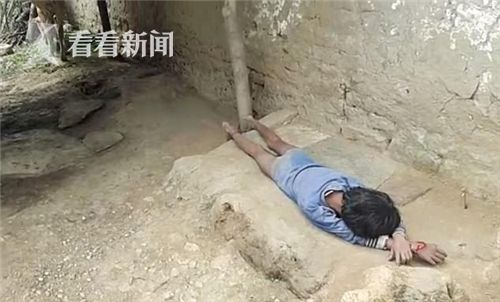 印度残障儿童被家人当作畜牲般对待 被绑树上长达5年