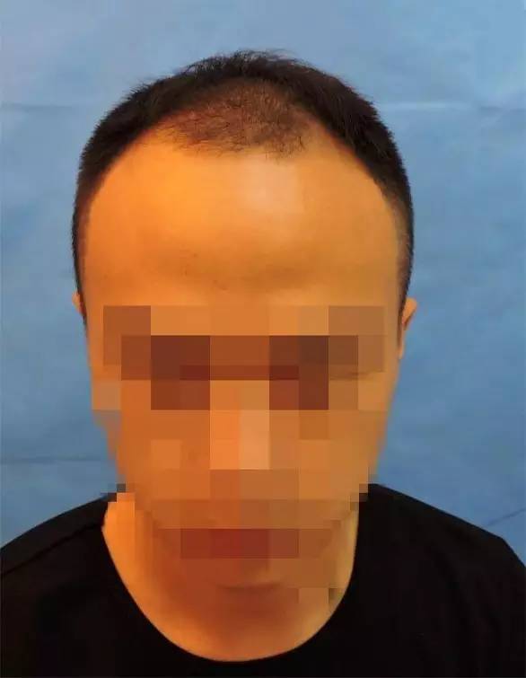 同一个人,为何差别这么大?一个像大叔,一个小