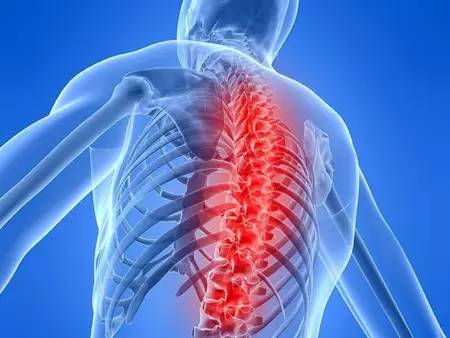 个女性头号癌症杀手,你知道多少?|骨折|中山大