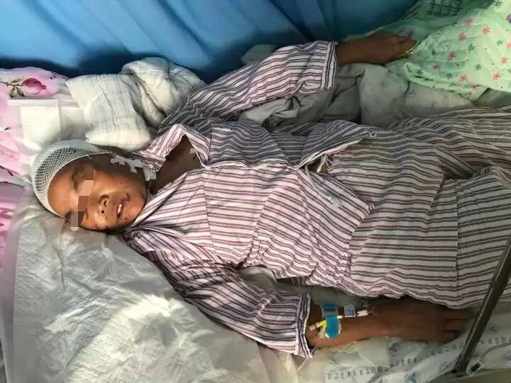 珲春女子上山采药时遭遇黑熊,它们可不是熊大