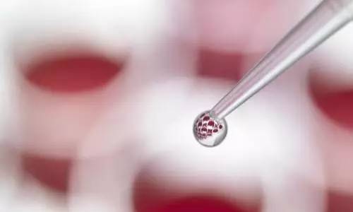 院用中国人当实验 小白鼠 |脐带血|造血干细胞|