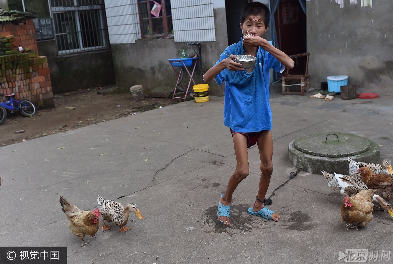 安徽17岁男孩被栓井边十余年 与鸡鸭一起抢食