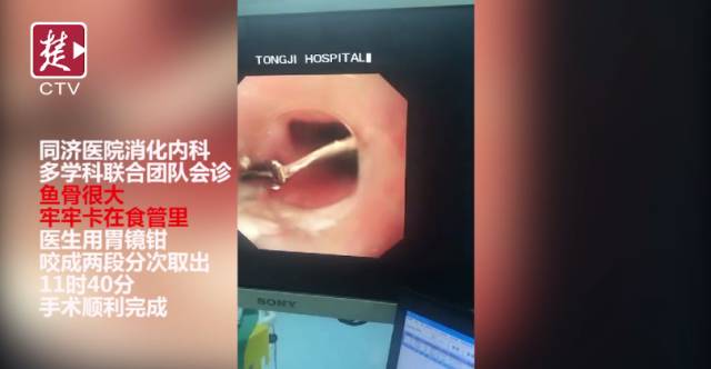 这道菜实在鲜!他吃了后被紧急送医,医生吓得不