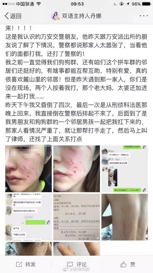 美女主持自曝遛狗未拴绳遭暴打，半边脸“毁容”，网友吵翻了