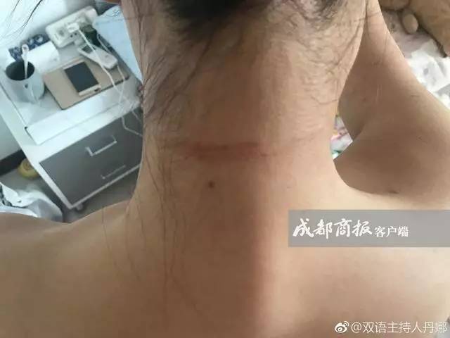 美女主持自曝遛狗不拴绳遭暴打“毁容”？！到底是谁错了？