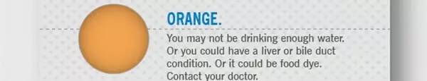 |棕色尿液|图片来源：clevelandclinic.org|