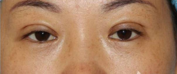 Gai女友怼红花会弹壳女友双眼皮割得丑|网红|双