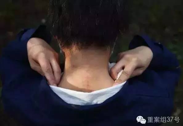 八达岭老虎伤人事件受伤女子索赔69万 其母死