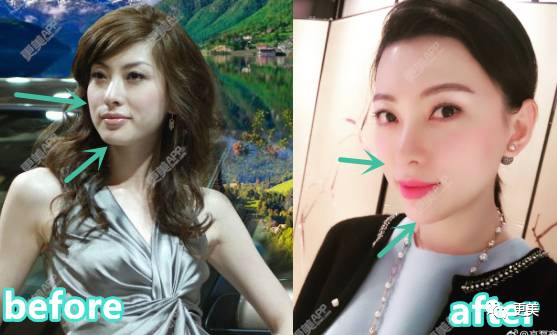 薛之谦和前妻复合,两人还动了3处同款“情侣整”