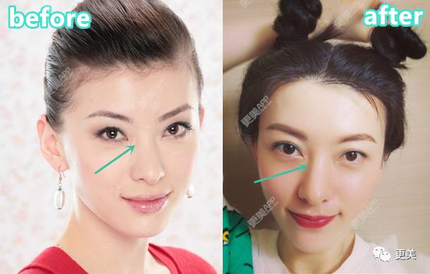 薛之谦和前妻复合,两人还动了3处同款“情侣整”