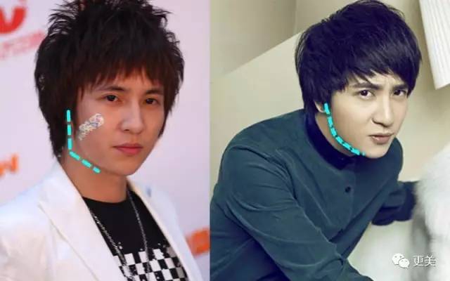 薛之谦和前妻复合,两人还动了3处同款“情侣整”