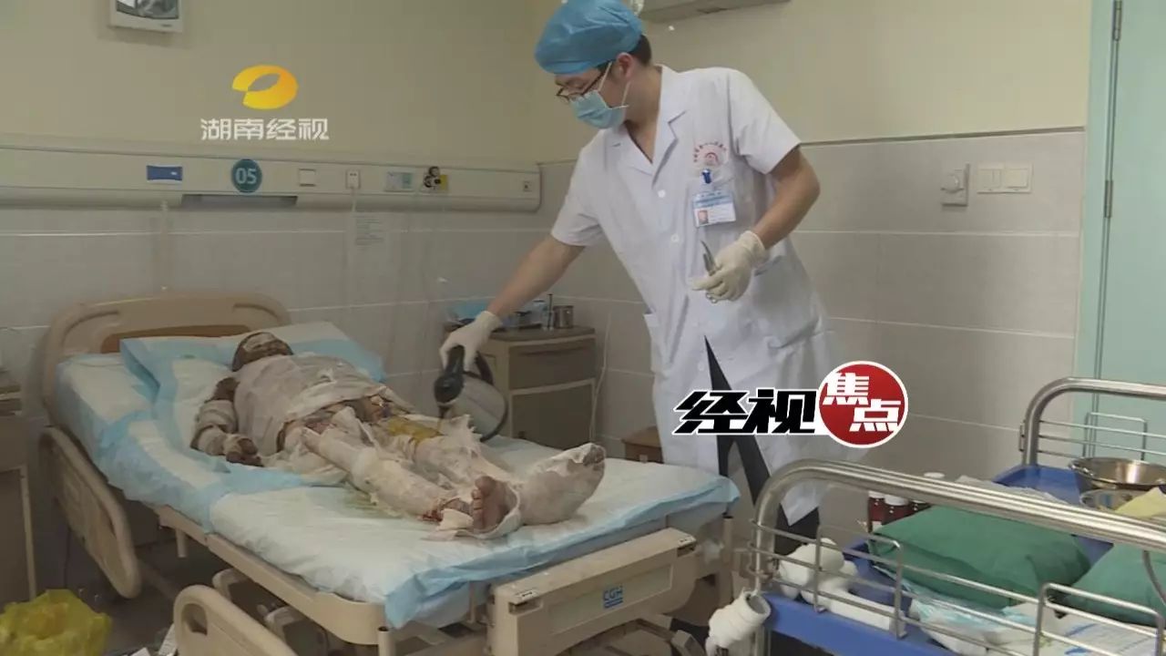 孝子!娄底男子割皮救母:这是作为儿子的本能|张