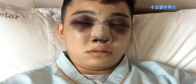 重庆小伙花7000元隆鼻 直接毁容|隆鼻|重庆|毁