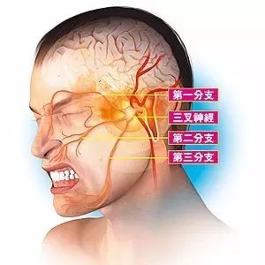 【健康】头疼原因不在 头 !这几种情况你绝对想