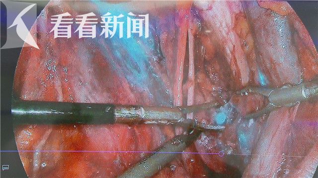 双创周启动在即 上海涌现一批打破国际垄断创