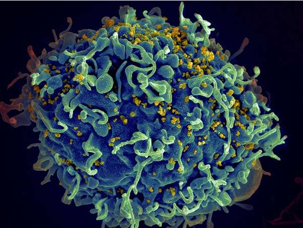 新艾滋病疫苗对猴子长期有效 现在进入人类临