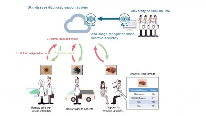 京瓷与日本筑波大学合作 用AI掌握皮肤癌特征