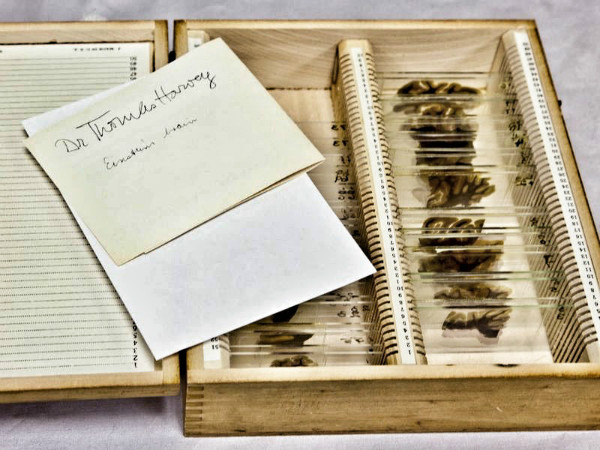 神奇的费城穆特博物馆:爱因斯坦大脑、总统口腔及泰国连体人|穆特|费城|泰国_新浪新闻