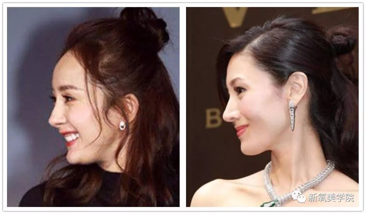 女明星们为什么不惜变寿星也要拼命填额头