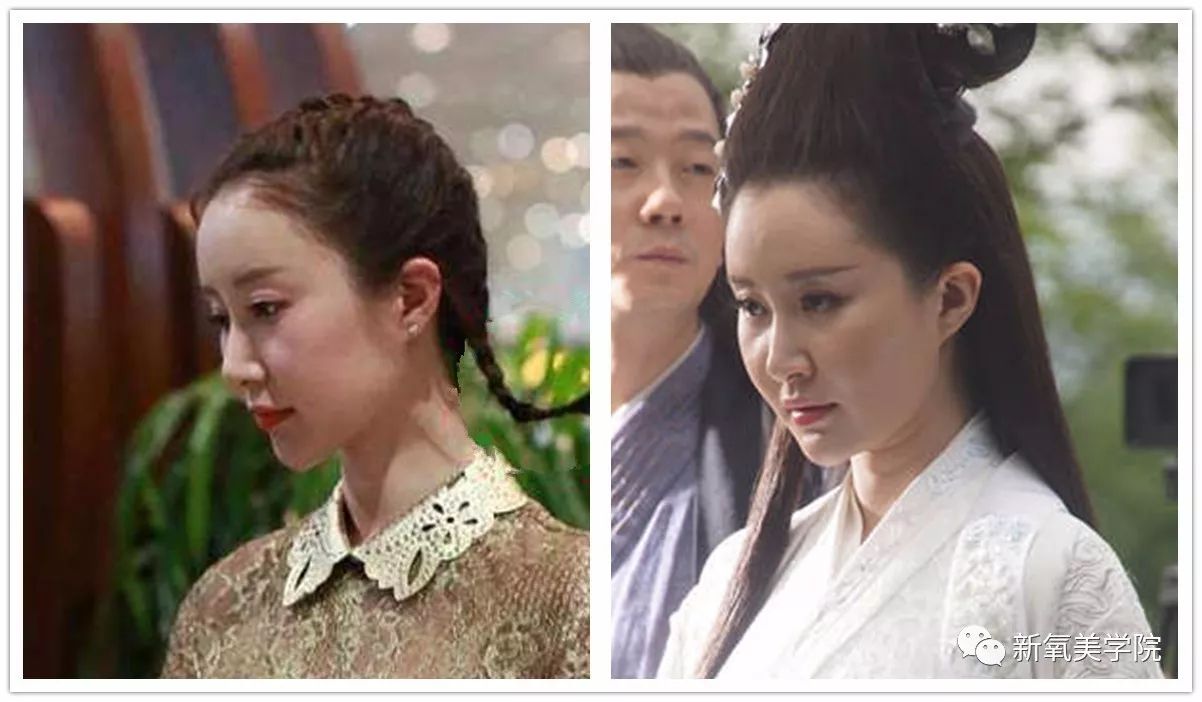 女明星们为什么不惜变寿星也要拼命填额头