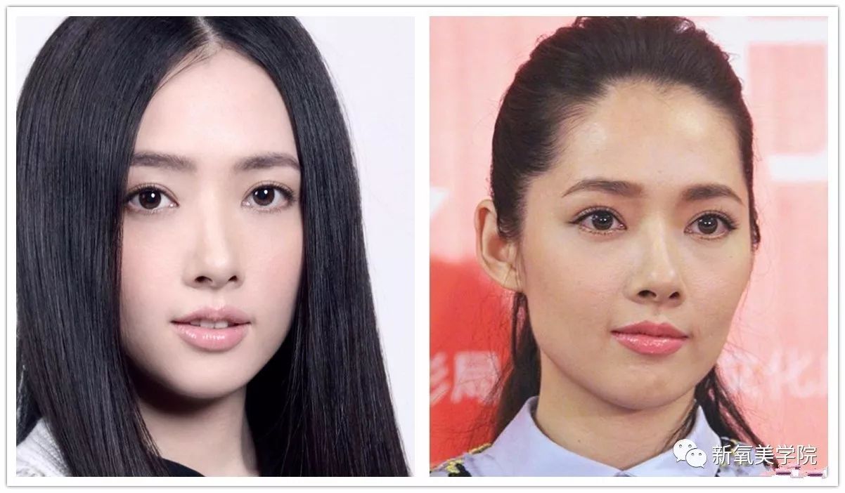 女明星们为什么不惜变寿星也要拼命填额头