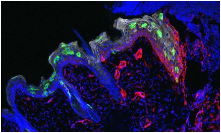 Nature:炎症记忆促进皮肤上皮干细胞更快地修