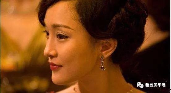 郭碧婷现在凸嘴+下巴后缩,是戴牙套造成的吗?