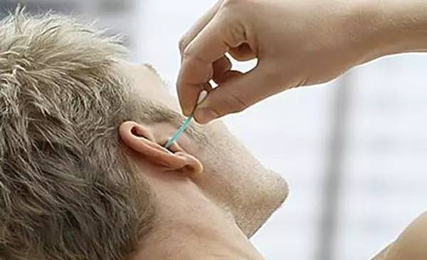 注意!喜欢用棉签掏耳朵的南京人赶紧看看!小心