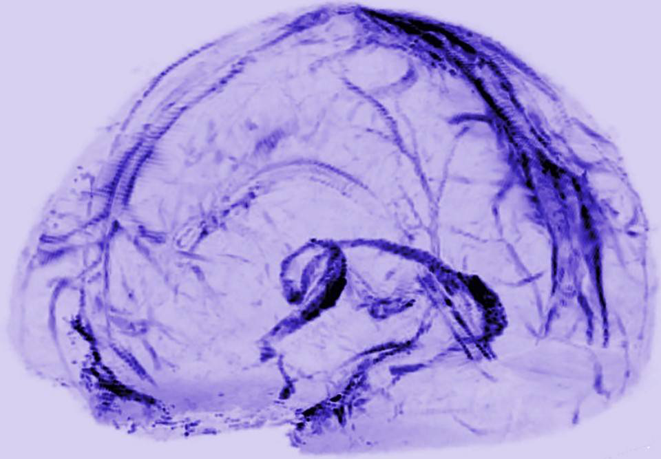 大脑排毒系统揭晓:科学家首次在人脑发现淋巴
