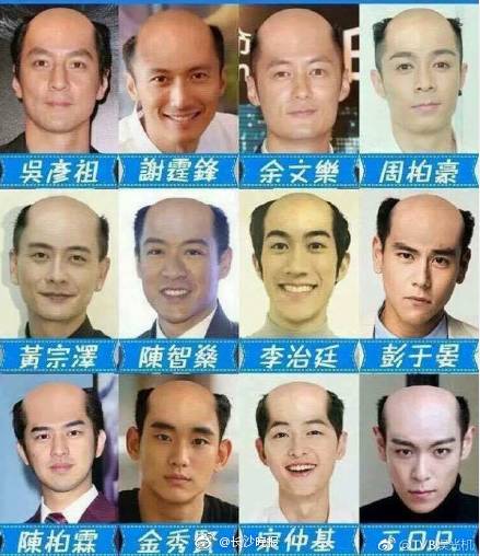 霸王老总脱发_霸王脱发(2)