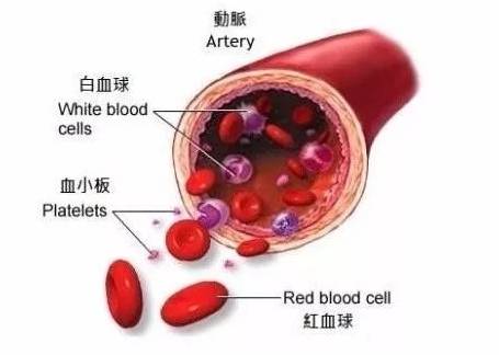 体检时该如何选择,看完这个故事你应该心里有